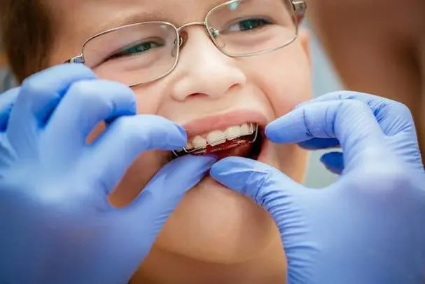12岁儿童牙齿矫正费用